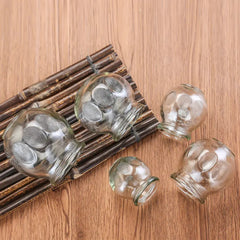 Schröpfgläser aus Glas, Feuerschröpfgläser