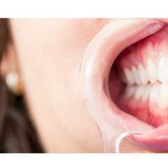 5 Stücke Mundöffner Dental C-form