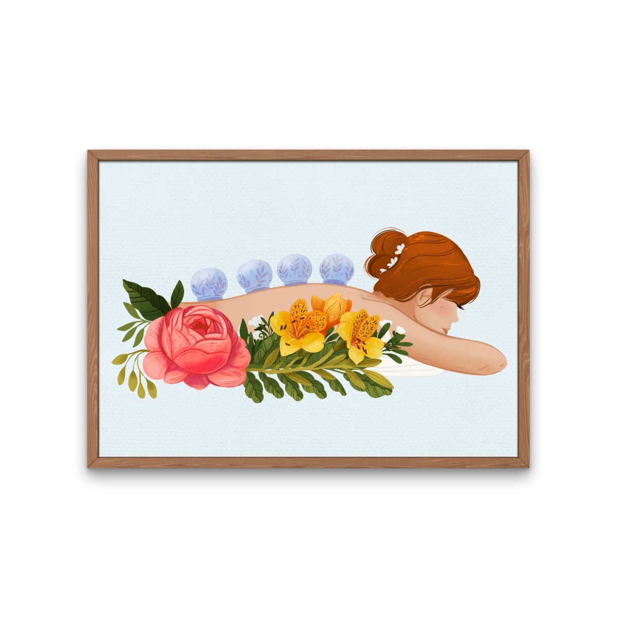 The Art of Cupping Therapy Poster 33x48,8 cm