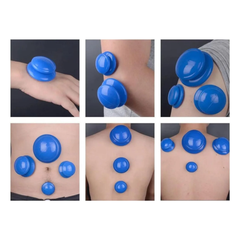 Silikon Schröpfset, 4-teilig (Blau)